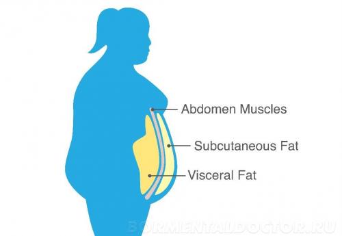 Висцеральное ожирение у женщин. Классификация: основные разновидности Выделяют 2 варианта чрезмерного накопления жира в области живота: