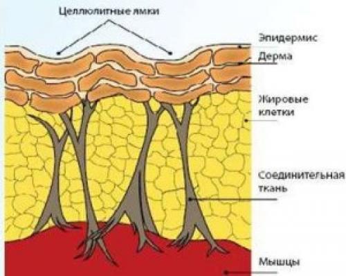 Чем плох лишний вес. Лишние проблемы от лишнего веса