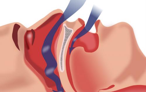 Что делать если постоянно кушать хочется. Заболевания 10 Что делать если постоянно кушать хочется. Заболевания 10