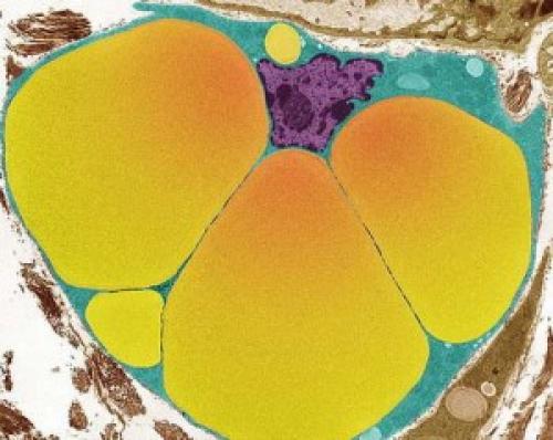 Чем плох лишний вес. Лишние проблемы от лишнего веса