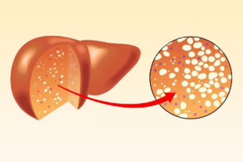 Таблетки для очищения печени. Препараты для чистки печени 04 Таблетки для очищения печени. Препараты для чистки печени 04