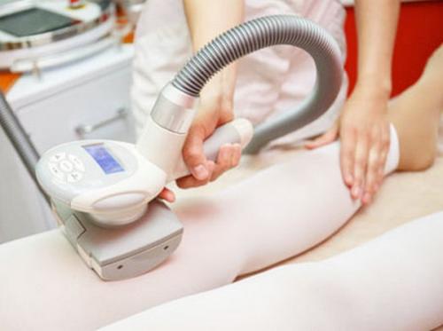 Аппарат для похудения lpg. LPG массаж: описание процедуры