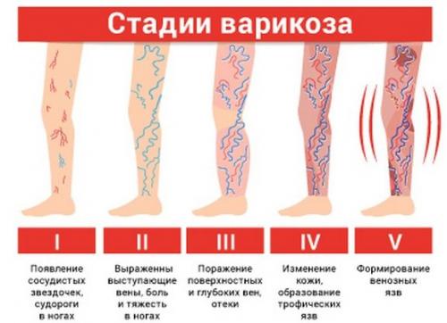 Аппарат для похудения lpg. LPG массаж: описание процедуры