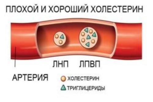 Как понизить холестерин в домашних условиях. Как снизить холестерин в домашних условиях