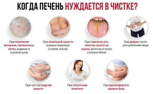 Чистка печени по морицу. Очищение печени с помощью методики Андреаса Морица — правила чистки