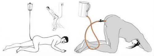 Чем сделать клизму. Главные этапы 01 Чем сделать клизму. Главные этапы 01