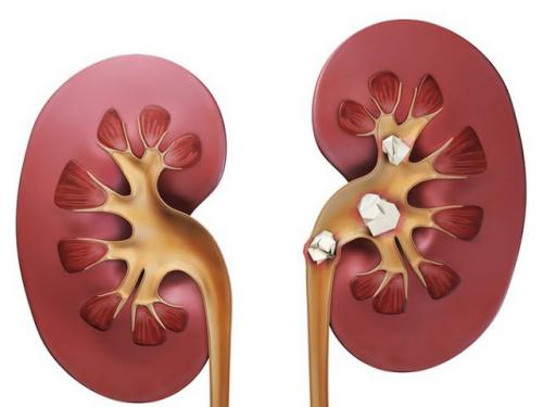 Урологический сбор для женщин. Состав и особенности Фитонефрола