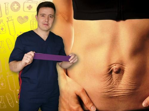 Тейпирование дряблого живота. Помогаю жене убрать живот после родов с помощью кинезиотейпирования