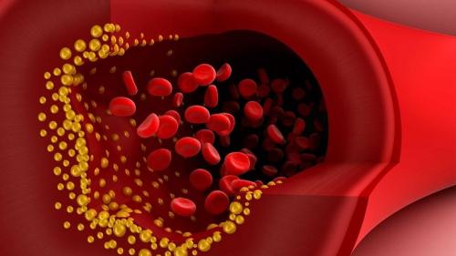 Лимон и сода для похудения. Рецепты для похудения 04 Лимон и сода для похудения. Рецепты для похудения 04