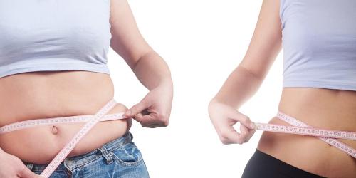 Шунтирование желудка, что это такое. Показания 03 Шунтирование желудка, что это такое. Показания 03