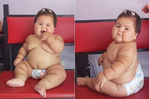 У ребенка ожирение 2 степени, что делать. Как определить — таблица стадий по возрасту