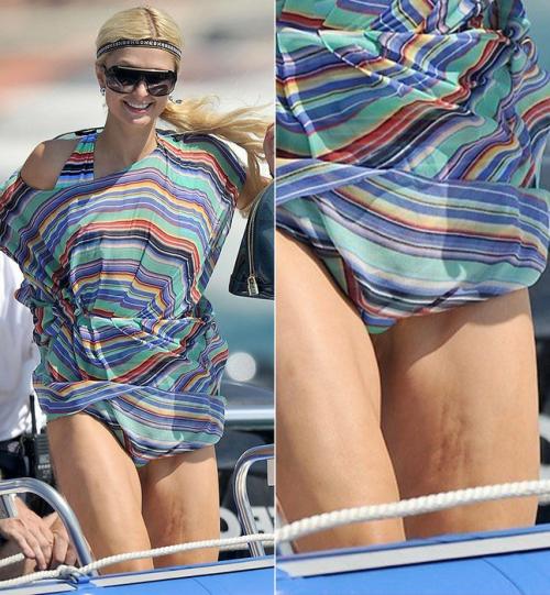 Целлюлит у звезд. 10 самых целлюлитных звездных поп