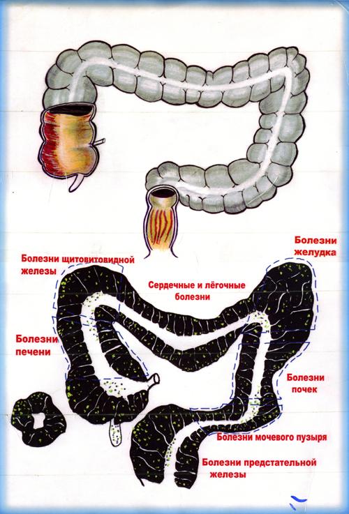 Оганян Марва Вагаршаковна - очищение организма: мнения людей 05 Оганян Марва Вагаршаковна - очищение организма: мнения людей 05