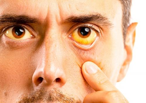 Средство для чистки печени. Для чего и как часто нужно очищать печень