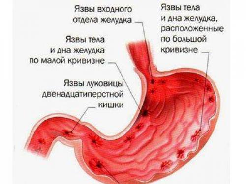 Как заварить овес в термосе для печени. Почему полезно производить чистку печени овсом