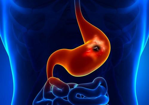 Постоянно хочется кушать сосет желудок. “Сосет под ложечкой”: причины