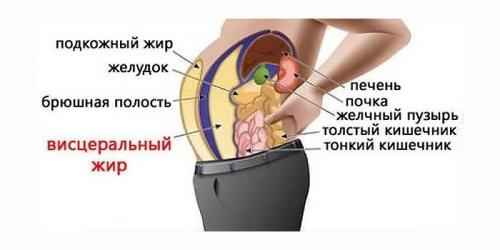 Ожирение 2 степени: как лечить заболевание