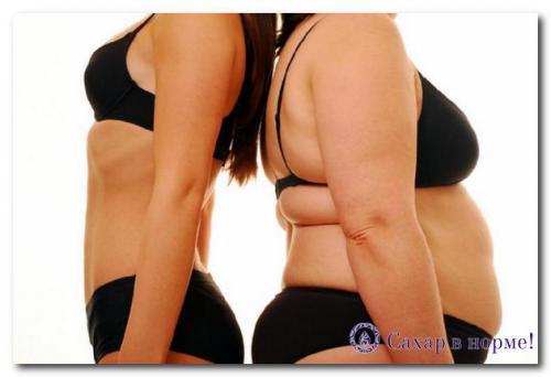 Виды ожирения у женщин. Типы ожирения у женщин: классификация 08