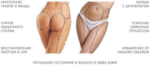 Антицеллюлитный массажер. Виды массажеров от целлюлита и особенности их применения