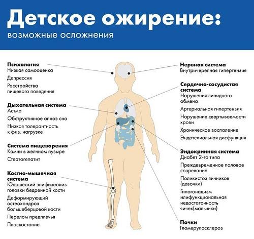 Ожирение 2 степени у детей. Как определить — таблица стадий по возрасту