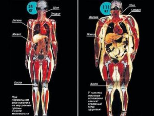 Ожирение внутренних органов. Чем опасно внутреннее ожирение и как его лечить?