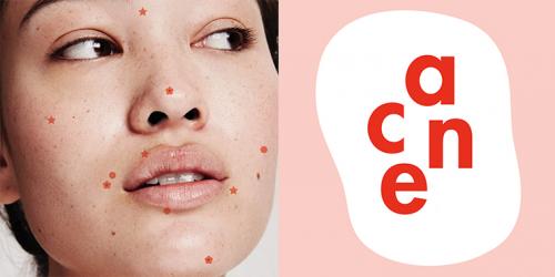 Маски для лица от прыщей и черных точек в домашних условиях. Особенности лечения прыщей в домашних условиях 01 Маски для лица от прыщей и черных точек в домашних условиях. Особенности лечения прыщей в домашних условиях 01