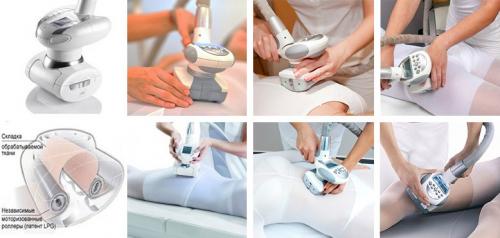 Массаж от целлюлита аппаратный. Польза и вред аппаратного вакуумного антицеллюлитного массажа