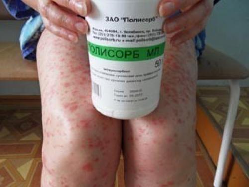 Полисорбенты для очистки организма. Как принимать Полисорб: инструкция 05 Полисорбенты для очистки организма. Как принимать Полисорб: инструкция 05