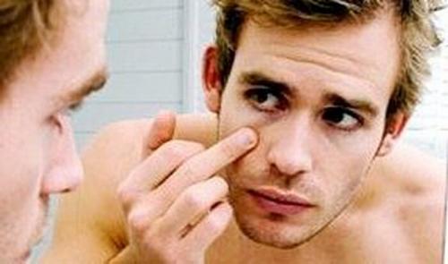 Синяки под глазами у мужчин. Круги, синяки и чернота под глазами у мужчин: причины