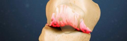 Вывести соли из суставов рисом. Как вывести соли из суставов?