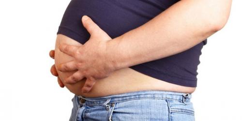 Виды ожирения. Симптомы ожирения: виды и лечение заболевания