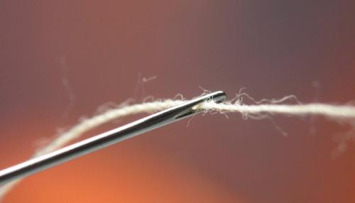 Как удалить бородавку ниткой. Перевязать ниткой папиллому: как это сделать без вреда для здоровья