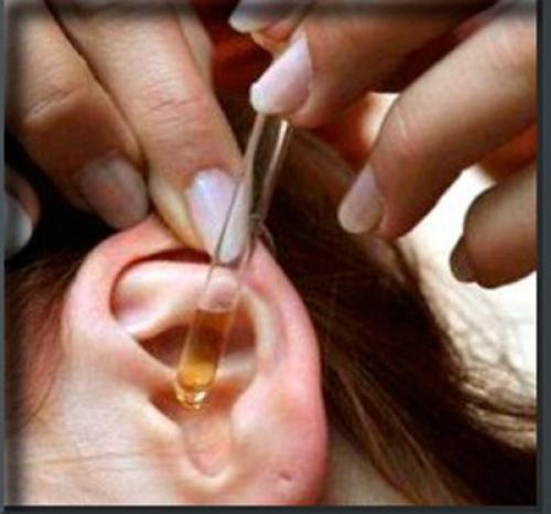 Миндальное масло применение в косметологии. Применение миндального масла в косметологии 10 Миндальное масло применение в косметологии. Применение миндального масла в косметологии 10