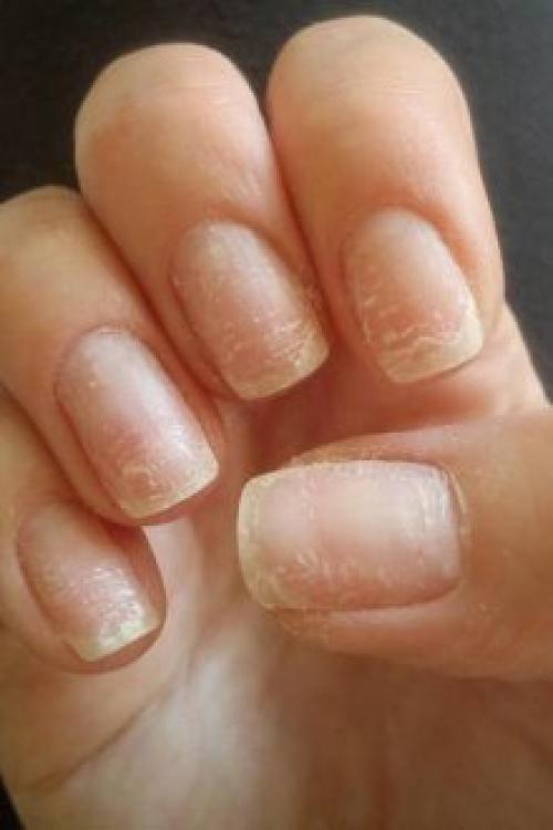 Почему не держится гель на ногтях. Почему отслаивается гель-лак от ногтей: причины и особенности