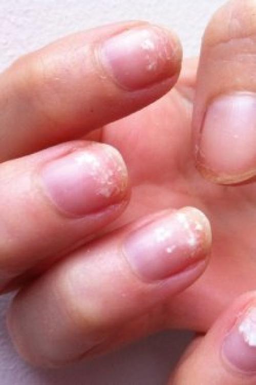 Почему не держится гель на ногтях. Почему отслаивается гель-лак от ногтей: причины и особенности