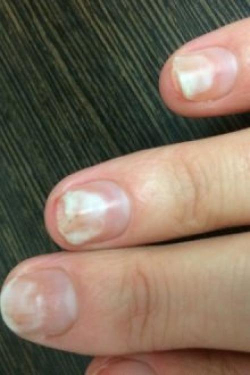 Почему не держится гель на ногтях. Почему отслаивается гель-лак от ногтей: причины и особенности