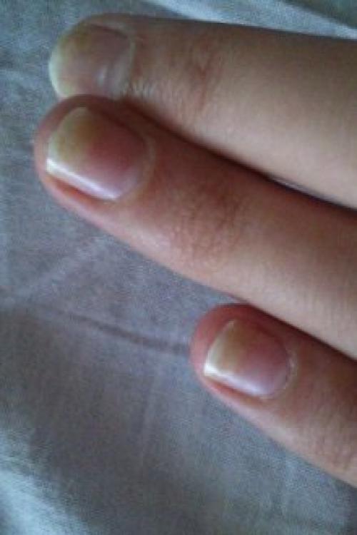 Почему не держится гель на ногтях. Почему отслаивается гель-лак от ногтей: причины и особенности