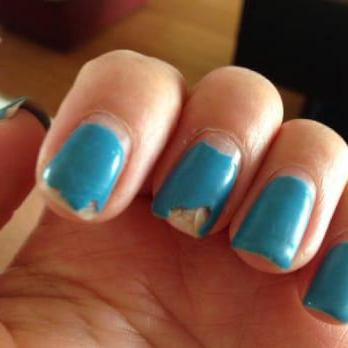 Что делать, чтобы не отслаивался гель-лак. Основные ошибки при нанесении гель-лака 25 Что делать, чтобы не отслаивался гель-лак. Основные ошибки при нанесении гель-лака 25