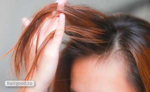 Как избавиться от жирности волос в домашних условиях. Особенности гигиены для быстро жирнеющих волос