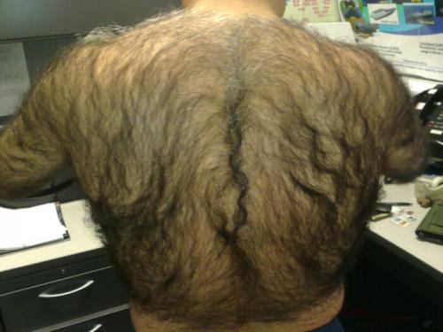 Удаление волос у мужчин в домашних условиях. Как избавиться от волос на спине?