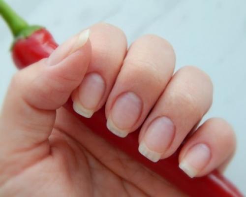 Грибок ногтей на руках лечение в домашних условиях. Методы борьбы с грибком ногтей в домашних условиях