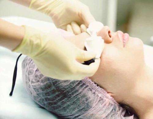 Карбоновый пилинг показания. Что такое карбоновый пилинг и карбоновая чистка лица, карбоновое омоложение?