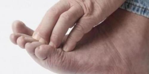 Между пальцами ног облазит кожа и запах. Преет кожа между пальцами ног и запах