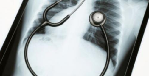 Колет под правой грудиной у женщины. Печеночная колика 04