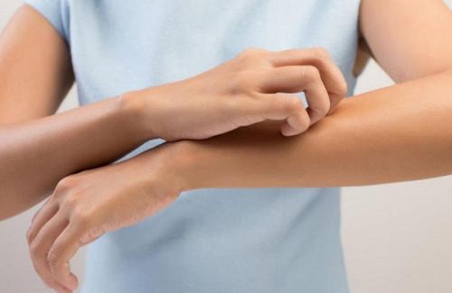 Таблетки от зуда кожи тела. Признаки зуда, какой он бывает