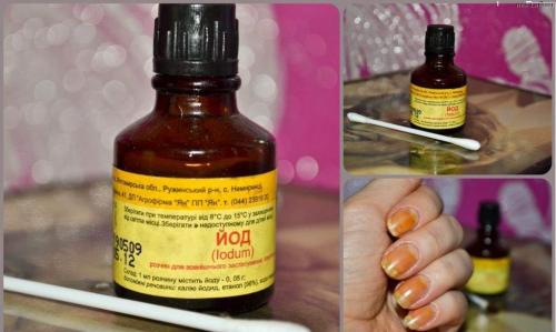 Подногтевой грибок на руках. Лечение грибка ногтей на руках народными средствами