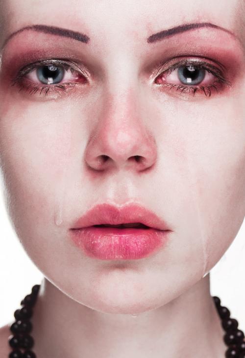 Почему отекают глаза после слез. Опухшие глаза после слез —, как быстро убрать отек?