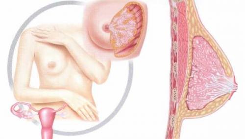 Уплотнение в нижней части молочной железы. Опасно или нет? 01