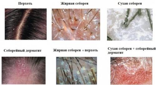 Резкое покраснение кожи и зуд. Народные средства