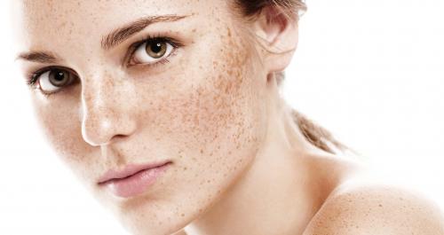 Лучший отбеливающий крем для лица. Отбеливающий крем для лица